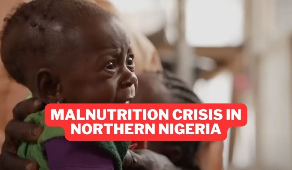 malnutrition crisis in Northern Nigeria